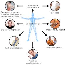 posturologie clermont de l'oise